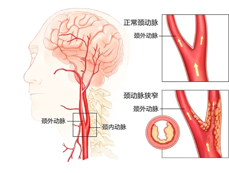 图片 1.png