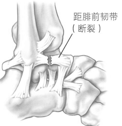 图片 2.png