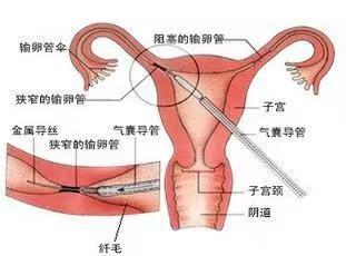 微信图片1