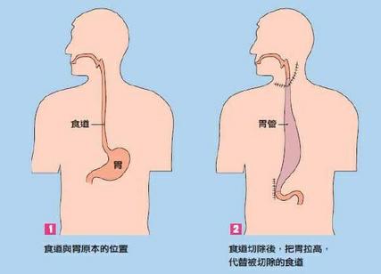 图片 1