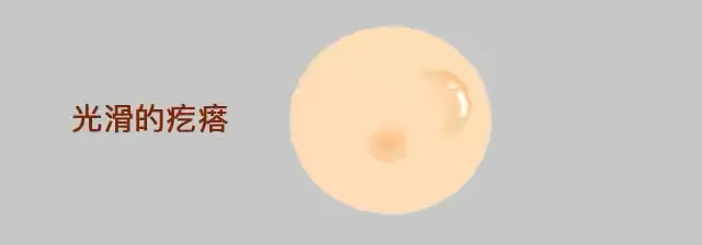 0005.png