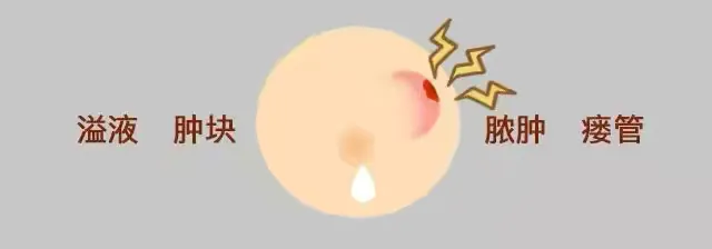 0003.png