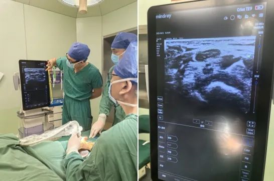 60岁阿姨双手麻木疼痛难握拳？微创技术精准解决腕管综合征困扰