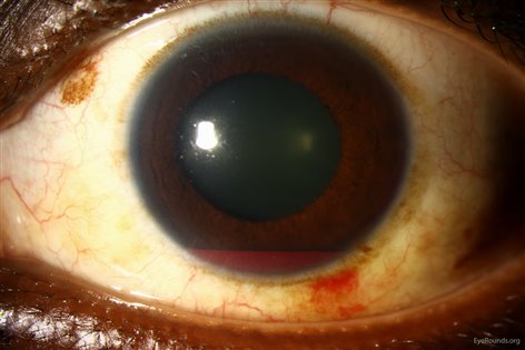 ff3eb3a568feeec87d96a1d3f0e61817