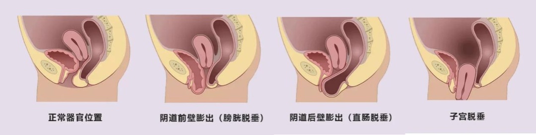 图片2_IMGC_75783851.jpg